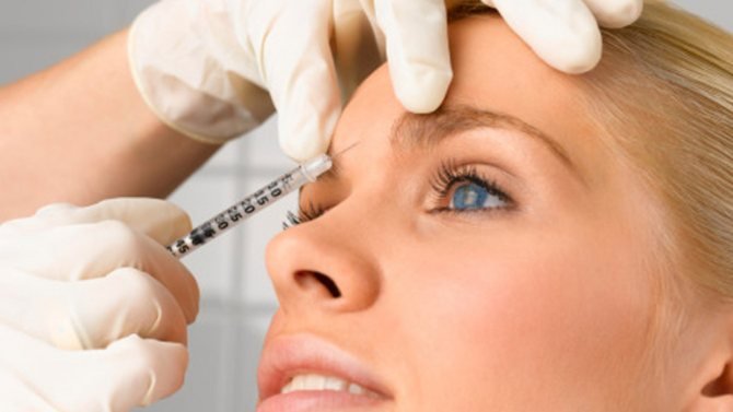 Ботулинотерапия